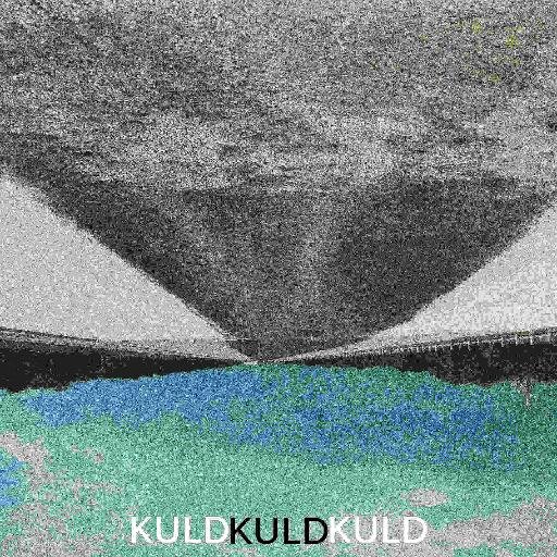 KULD