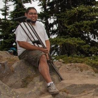 0neleggedwonder's profile picture. I have 1 leg, been like that since 2003 and in that time, I have learned there are a lot of things that make BEING DISABLED AWESOME! & I am ready to share.