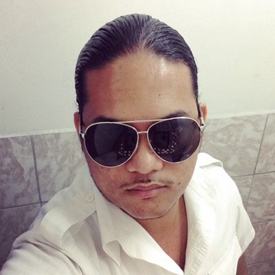 My Imperfections Make Me Unique, My Madness Makes Me A Genius, I'd Rather Be Absolutely Ridiculous And Different Than Normal And Boring!