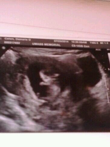 I'm a proud mother of two kids my son jexziel Reyes who is 4 may 27 and my Daughter Daxziely skiley Reyes born February 3rd of 2015