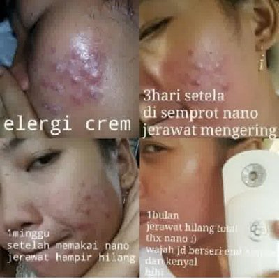 ms_spray's profile picture. Nano spray & Magic Stick Original
Surabaya, indonesia