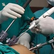 Canal de información para pacientes de la consulta de cirugía general y laparoscopica.