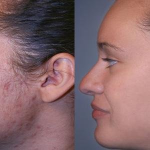 Skin, Beauty & Healthy tips Blog.