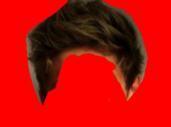 I am Niall' s hairline. don't piss me off or I will recede. I am planning to take over the world. be jealous, I've been best friends with Niall since birth