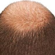 pendexagoras's profile picture. Si me engañas una vez, tuya es la culpa; si me engañas dos, es mía.