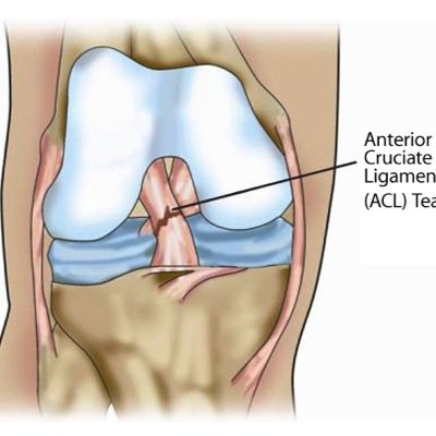 AclTeam's profile picture. 