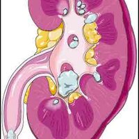 endourology (@endourology) 's Twitter Profile