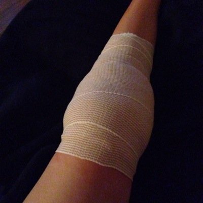 i dislocate my left kneecap daily. survived knee surgery & preparing for another. if you have any questions, just ask (: