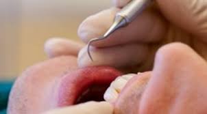 Dental SEO and local SEO for South African Dentists