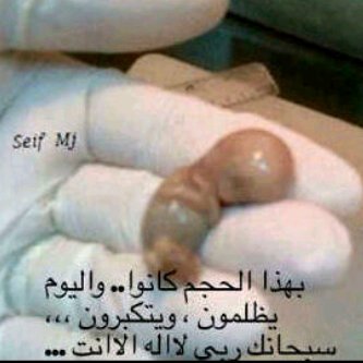 Z3lannMnhm's profile picture. الدكتور/عبدالعزيز الجدعاني  أخصائي امراض باطنيه