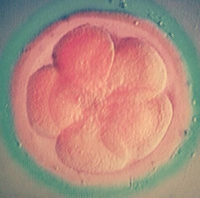 Lic. en Biología, UCVista. Apasionada por la Reproducción Asistida... Instagram: @isoinvitro y @_cenfer