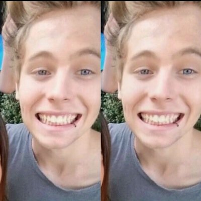 \\ @Alloverluke