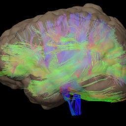 Please follow @BrainPowerASD