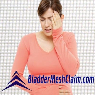 If you have  complications due to Transvaginal/Bladder Mesh surgery, you could earn a HUGE cash settlement. Contact us - FREE consultation - get paid today!