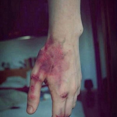 17. Tengo miedo de mis propios pensamientos, por que sé que me estan ganando. Otra mas que hace una segunda cuenta para poder desahogarse. MF:45