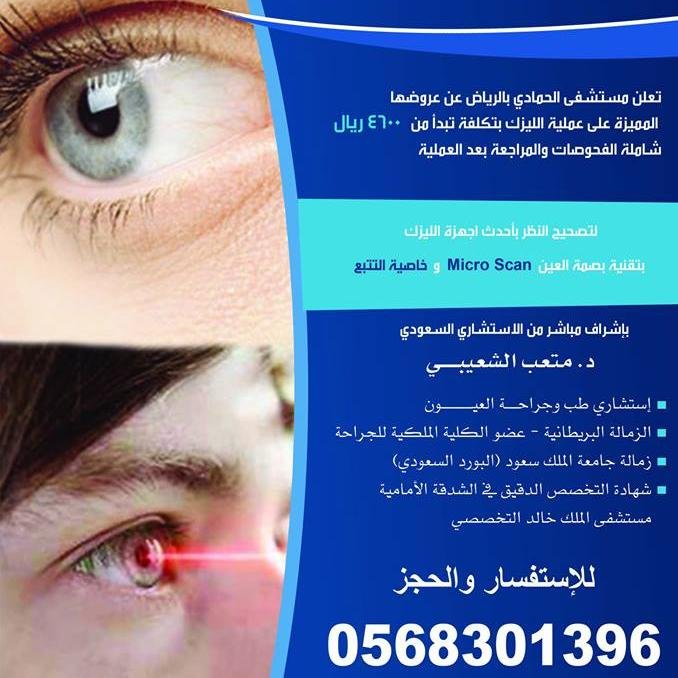 الليزك وتصحيح النظر