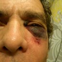 Jonathan Bloom - @jonathanbloom91 - Twitter