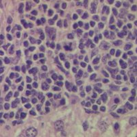 Mark Arends (@pathologyedin) 's Twitter Profile
