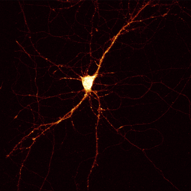 Epilepsy Genetics