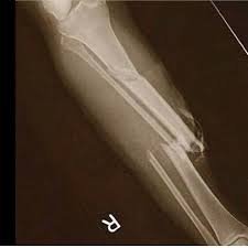 #PRAY FOR PAUL GOERGE