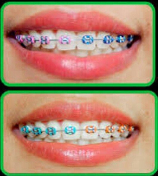 sms/wa 087839976925