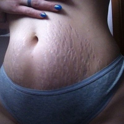 #pregnant and post pregnancy bellies. Sexy mommy tummies. #hairybeaver is the cherry on top.