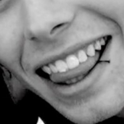 lukestoothspot's profile picture. Luke's spot on his tooth is brighter than your future