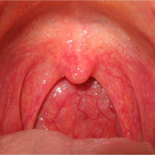 A Blog Provide Complete Information About Sore Throat And Allergies