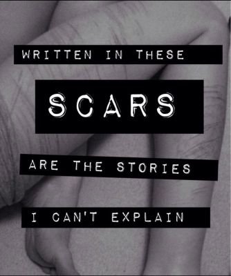 we're all suicidal kids telling other suicidal kids that suicide isn't the answer. / the worthless one