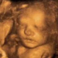 TummyTime_Salia's profile picture. At Tummy Time we truly consider it a privilege to share with you in the unique pre-labor event only 3D and 4D imaging can bring.