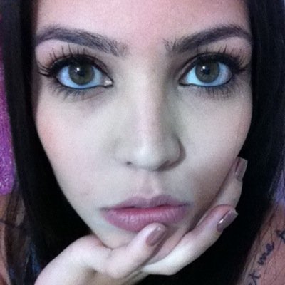 so conjuntivite da capricho