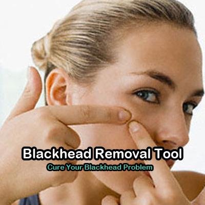 Banish bad skin day for good, Cure your blackhead problem once and for all