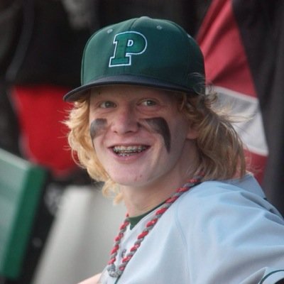 Life is very simple, the answer is baseball. PA '17