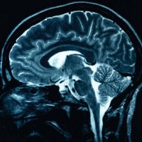 Olivier George (@brainaddiction) 's Twitter Profile Photo Olivier George (@brainaddiction) 's Twitter Profile Photo