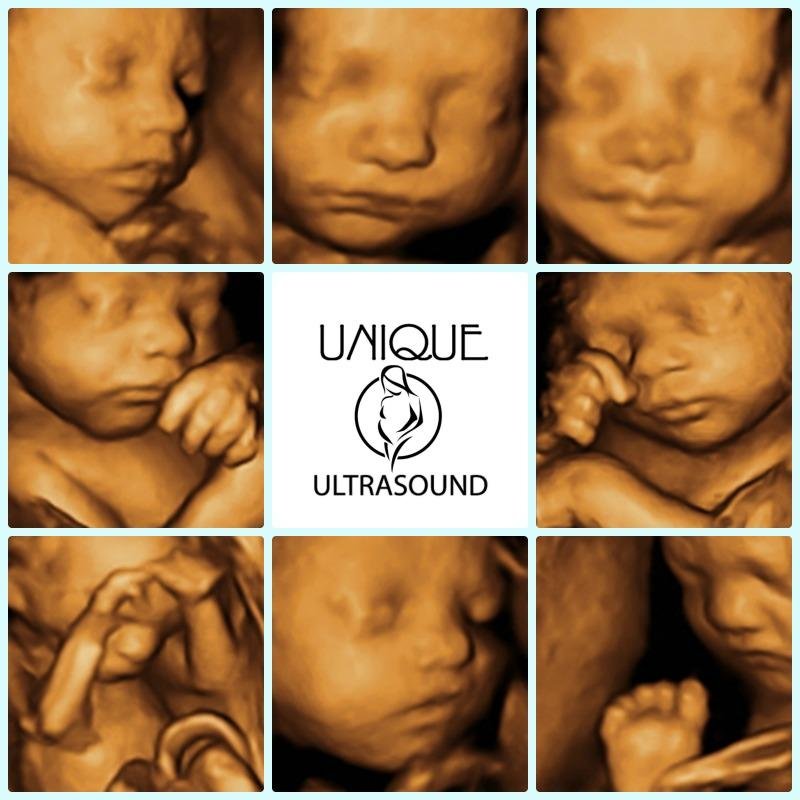 3D/4D Ultrasound and educating families about nutrition, fitness, childbirth and breastfeeding. We love sharing the LOVE that a baby brings!