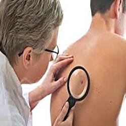 We help people to get rid of skin tags fast through the use of highly effective OTC products.