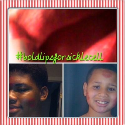 Advocate for the Sickle Cell Community at Large!