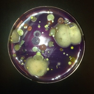 Follow what's happening in my Microbiology course and global microbial disease outbreaks.