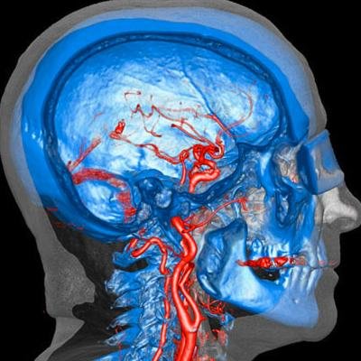 Radiology Imaging Professional by day and Airplane enthusiast by 24/7. Living on the Oshkosh, WI area and specializing in Local Wisconsin Adventures for EAA!!!
