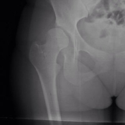 Orthopedic Surgeon, Hip and Knee Prosthesis, Grunge, Old Heavy Metal, y una pizca de Electronica