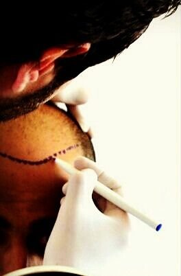 أفضل مركز زراعة شعر
Best Hair Transplant Center
Instagram/@best_hair_tc
WhatsApp:00905392115477
Tel:00905392115477