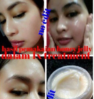 Honey jelly membuat wajahmu jadi kinclong jerawat,flek hitam lewat 7DB583E1 / 08993024377