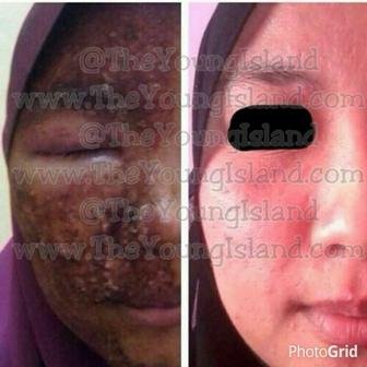Healthy-SkinCare~SlimmingCare~Clothing~Accessories
SMS:(+62)8567-111-200
BBM:7d256562
LINE/IG/TW:theyoungisland 
FanpageFB: http://t.co/zFRcpOALoK