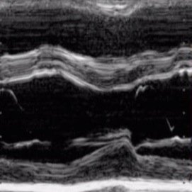 Para iniciarse en la ecocardioscopia o utilizacion de la ecocardio por el no cardiologo.Asociacion Española de Imagen Cardiaca-@MAecocardio MA Garcia Fernandez