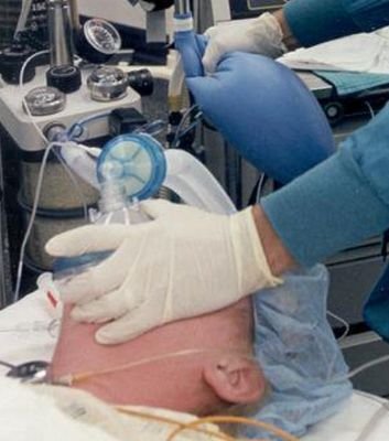 تخدير  Anesthesia