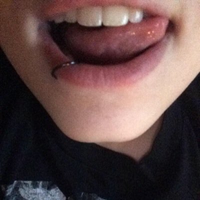 A page dedicated to Cody Herbinko's teeth