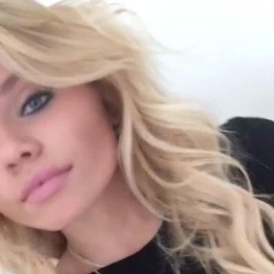Alli Simpson is an inspiration to millions of people, including me.❤