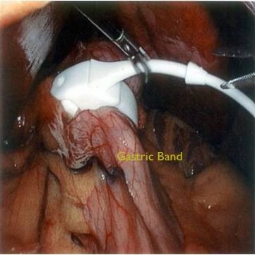 Advance of technology made more demanding techniques feasible and safe. Dr Farrakha operates in major hospitals in