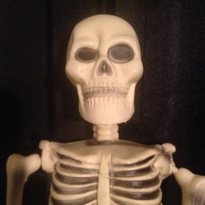 Im an skeleton. Prepping for the skeleton war. Cause of death: hepatitis!!!!!