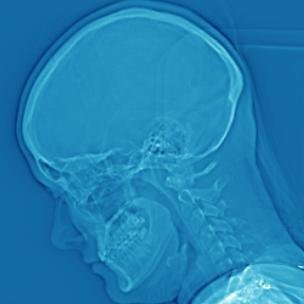 CONDITIONAL PUBLICATIONS: Books by and about people with neurological disorders: OCD, Tourette's, ADD, Autism, Bipolar, Epilepsy, Schizophrenia, Anxiety.